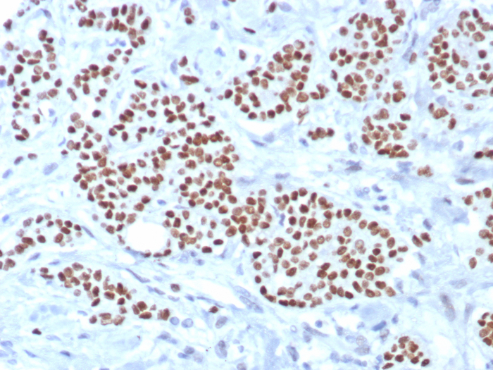 TRPS1 Antibody (TRPS1/8008R) - Azide and BSA Free