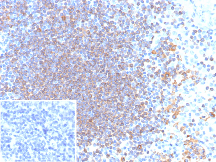 CD79A Antibody (rIGA/6986) - Azide and BSA Free