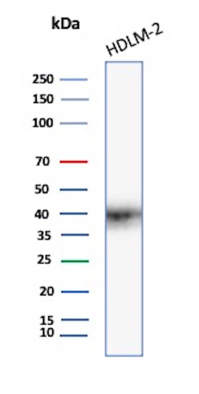 PD-L1 Antibody (PDL1/7568R) - Azide and BSA Free Western Blot: PD-L1 Antibody (PDL1/7568R) - Azide and BSA Free [NBP3-21060] -