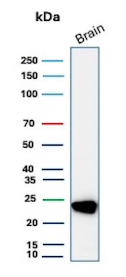 UCH-L1/PGP9.5 Antibody (UCHL1/8107R) - Azide and BSA Free Western Blot: UCH-L1/PGP9.5 Antibody (UCHL1/8107R) - Azide and BSA Free [NBP3-21061] -