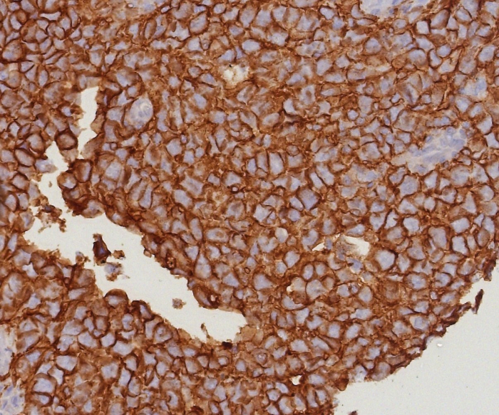 EpCAM/TROP1 Antibody (EGP40/8191R) - Azide and BSA Free