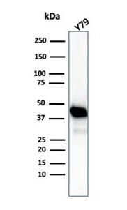 Creatine Kinase BB Antibody (CKBB/6565) - Azide and BSA Free Western Blot: Creatine Kinase BB Antibody (CKBB/6565) - Azide and BSA Free [NBP3-21074] -