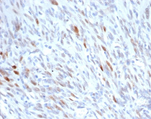 MDM2/HDM2 Antibody (MDM2/7190R) - Azide and BSA Free