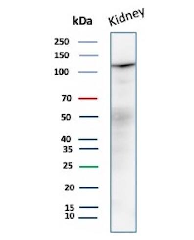 MDM2/HDM2 Antibody (MDM2/7190R) - Azide and BSA Free Western Blot: MDM2/HDM2 Antibody (MDM2/7190R) - Azide and BSA Free [NBP3-21092] -