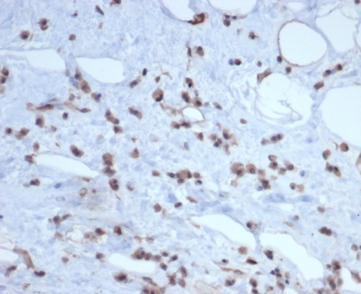 MDM2/HDM2 Antibody (MDM2/7189R) - Azide and BSA Free