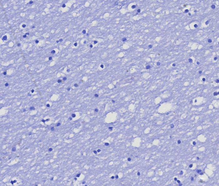 MGMT Antibody (MGMT/8364R) - Azide and BSA Free