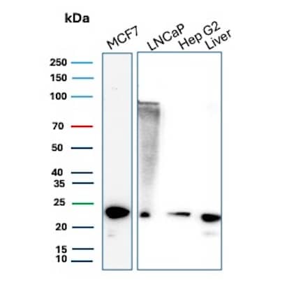 MGMT Antibody (MGMT/8364R) - Azide and BSA Free Western Blot: MGMT Antibody (MGMT/8364R) - Azide and BSA Free [NBP3-21104] -