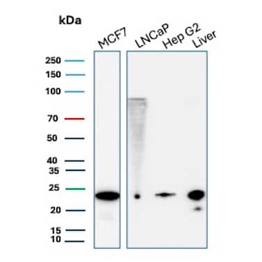 MGMT Antibody (MGMT/8186R) - Azide and BSA Free Western Blot: MGMT Antibody (MGMT/8186R) - Azide and BSA Free [NBP3-21106] -