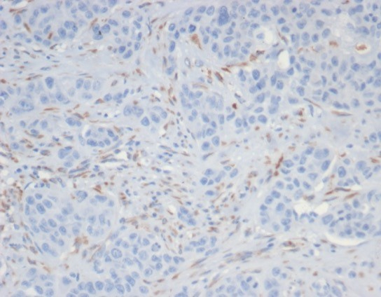 SALL4 Antibody (SALL4/7301R) - Azide and BSA Free