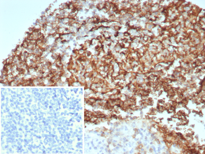 CD35 Antibody (CR1/8674R) - Azide and BSA Free