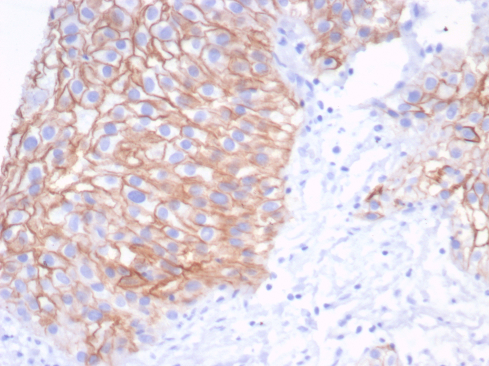 S100 calcium binding protein A14 Antibody (S100A14/7401) - Azide and BSA Free