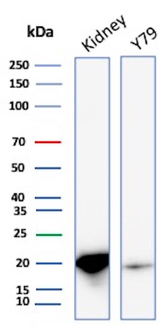 AlphaB Crystallin/CRYAB Antibody (CRYAB/4661) - Azide and BSA Free Western Blot: AlphaB Crystallin/CRYAB Antibody (CRYAB/4661) - Azide and BSA Free [NBP3-21137] -