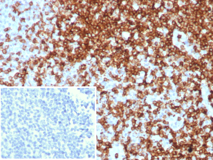 CD7 Antibody (CD7/8496R) - Azide and BSA Free
