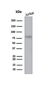 MLH1 Antibody (rMLH1/6285) - Azide and BSA Free Western Blot: MLH1 Antibody (rMLH1/6285) - Azide and BSA Free [NBP3-21143] -