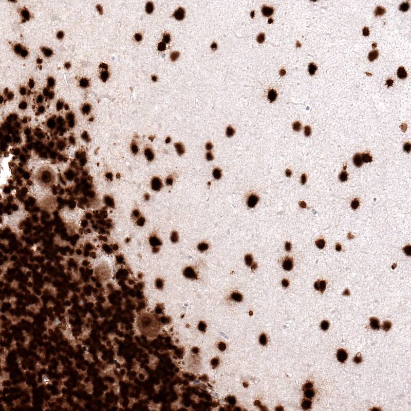 Immunohistochemistry-Paraffin: Histone H2AX Antibody [NBP3-21157] -