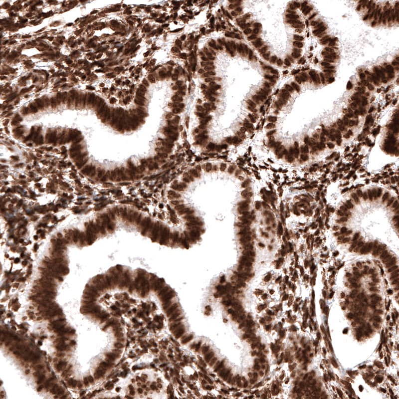 Immunohistochemistry-Paraffin: Histone H2AX Antibody [NBP3-21157] -