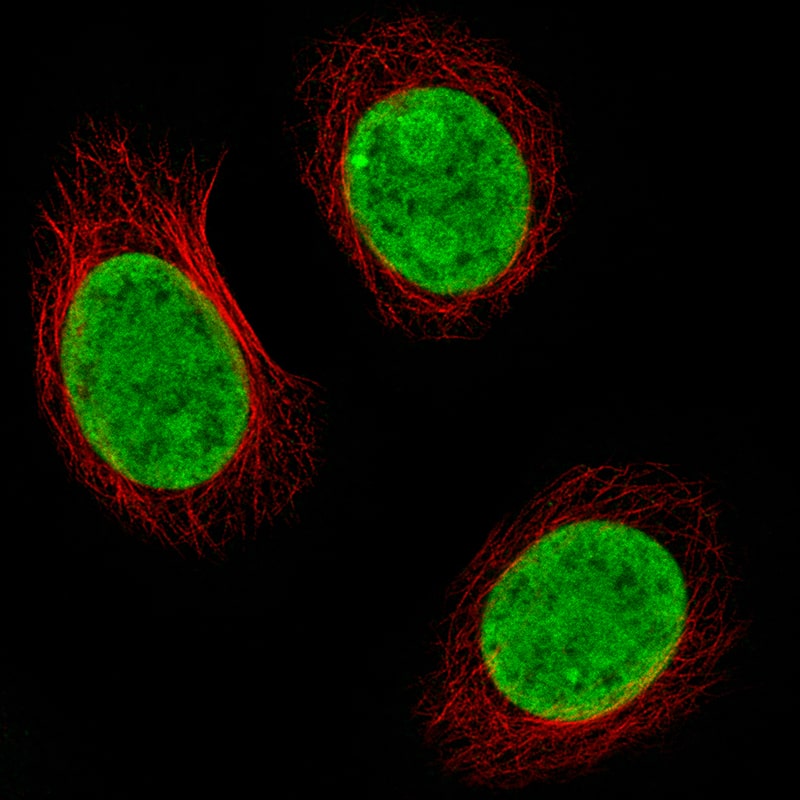 Immunocytochemistry/Immunofluorescence: Histone H2AX Antibody [NBP3-21157] -