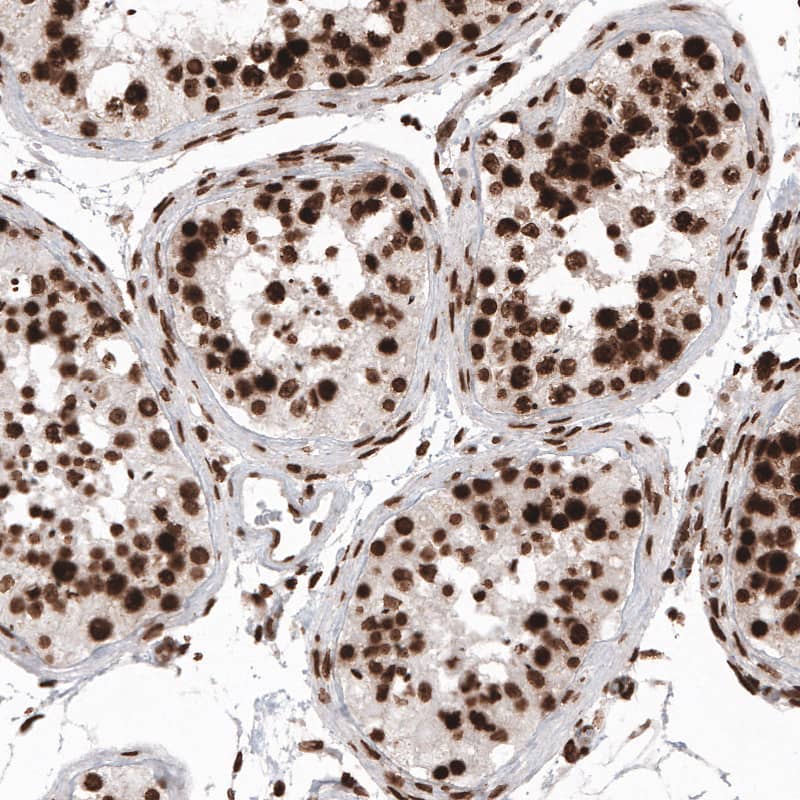 Immunohistochemistry-Paraffin: Histone H2AX Antibody [NBP3-21157] -