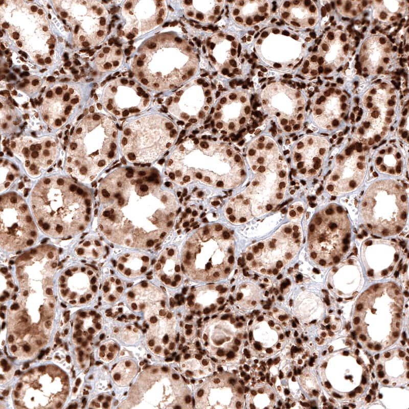 Immunohistochemistry-Paraffin: Histone H2AX Antibody [NBP3-21157] -