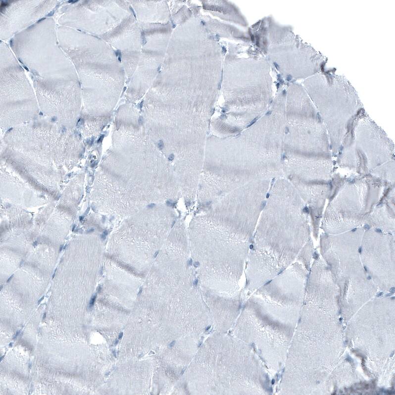 Immunohistochemistry-Paraffin: alpha-Fetoprotein/AFP Antibody [NBP3-21160] -