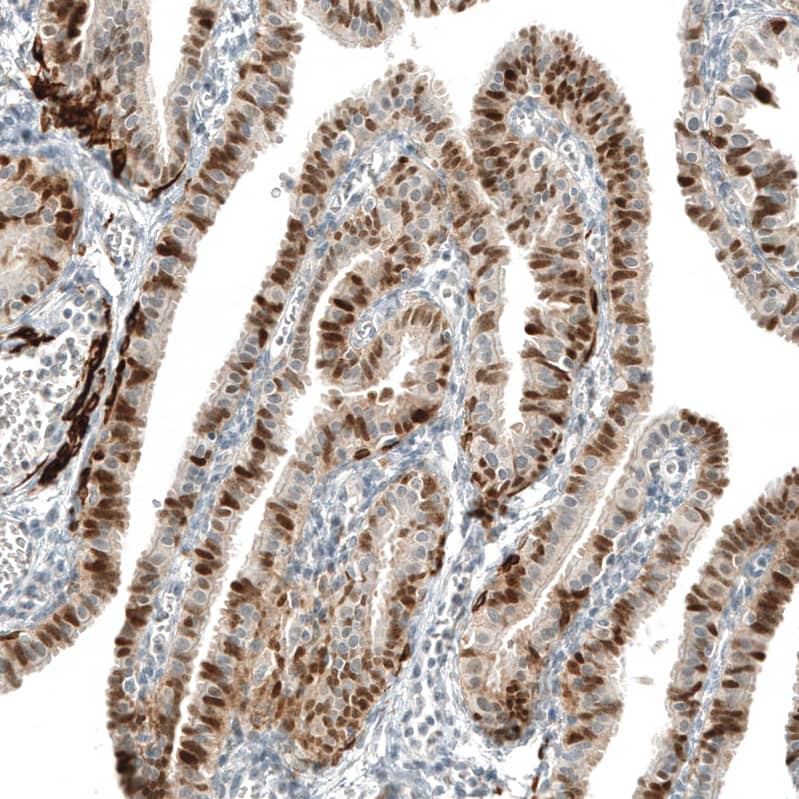 Immunohistochemistry-Paraffin: PAX8 Antibody [NBP3-21161] -