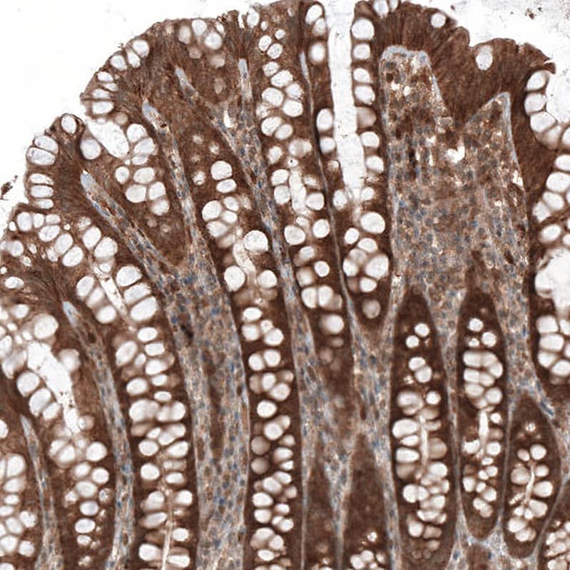 Immunohistochemistry-Paraffin: Bax Antibody [NBP3-21162] -