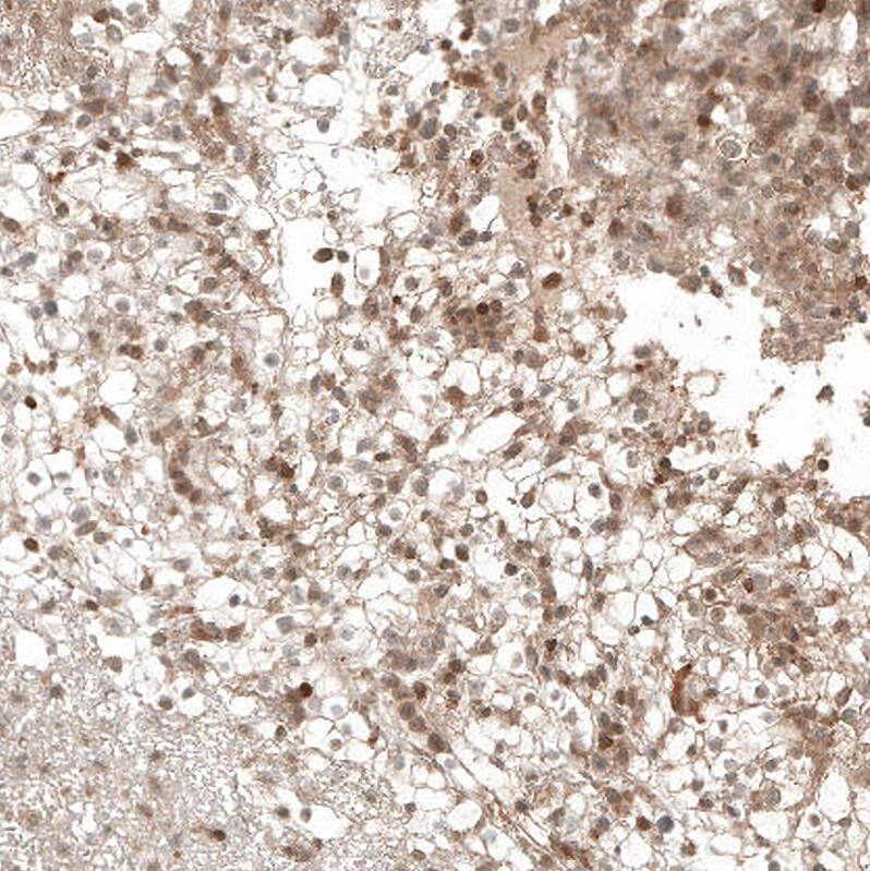 Immunohistochemistry-Paraffin: Bax Antibody [NBP3-21162] -