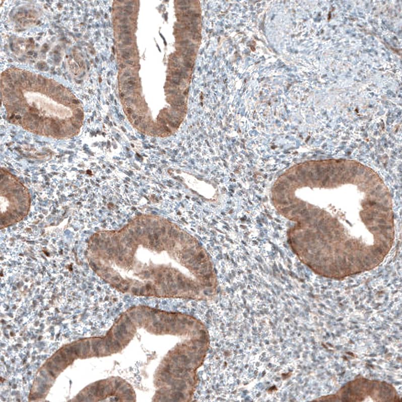 Immunohistochemistry-Paraffin: Bax Antibody [NBP3-21162] -