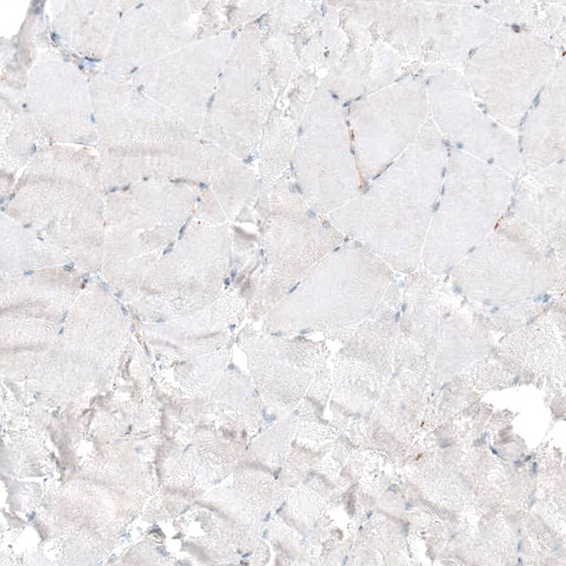 Immunohistochemistry-Paraffin: Bax Antibody [NBP3-21162] -