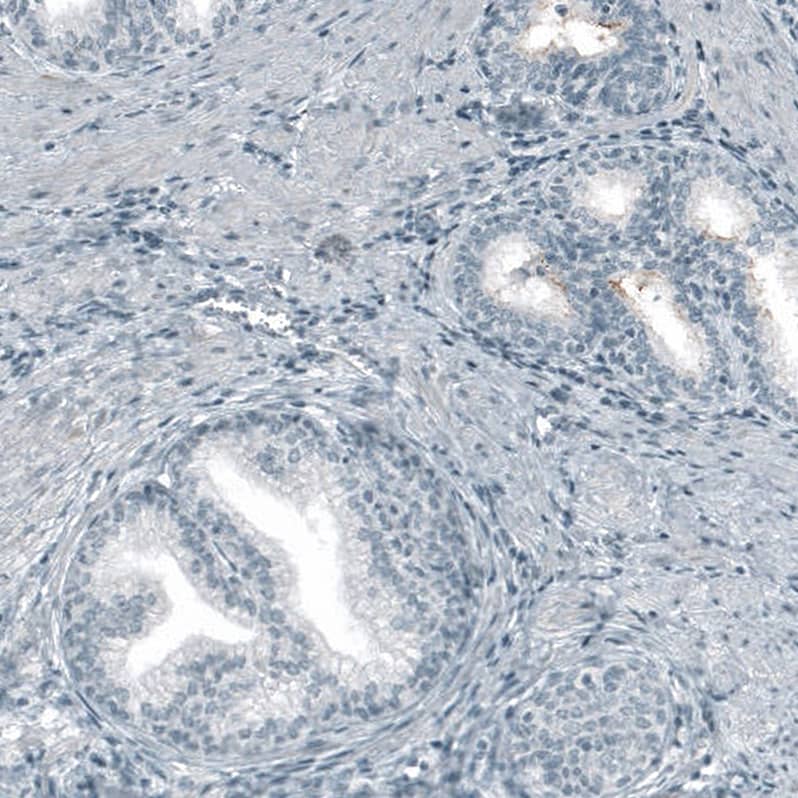 Immunohistochemistry-Paraffin: CD133 Antibody [NBP3-21163] -