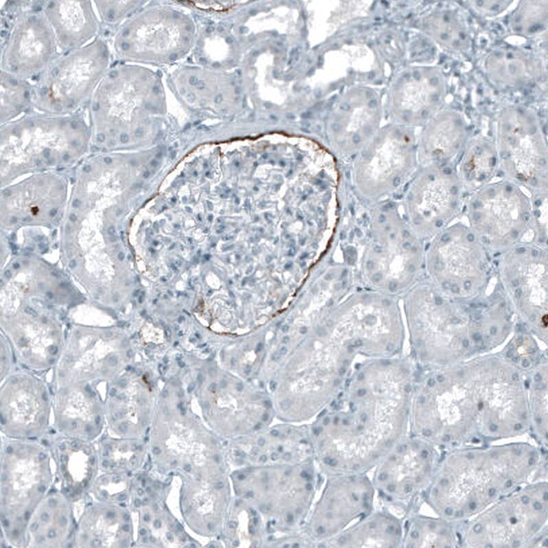 Immunohistochemistry-Paraffin: CD133 Antibody [NBP3-21163] -