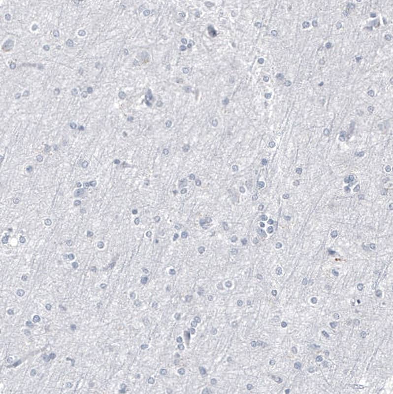 Immunohistochemistry-Paraffin: Progesterone R B/NR3C3 Antibody [NBP3-21167] -