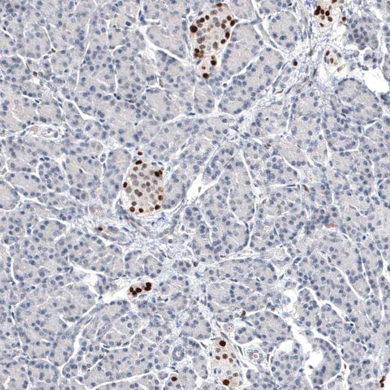 Immunohistochemistry-Paraffin: Progesterone R B/NR3C3 Antibody [NBP3-21167] -