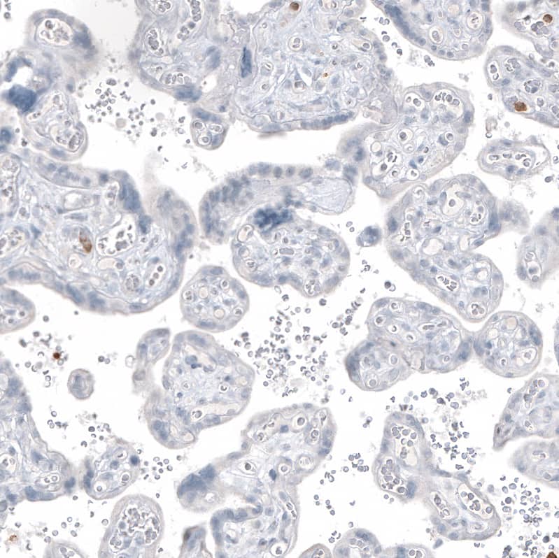 Immunohistochemistry-Paraffin: MUC2 Antibody [NBP3-21168] -