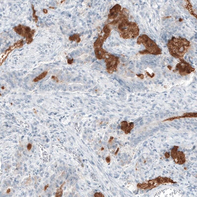 Immunohistochemistry-Paraffin: MUC2 Antibody [NBP3-21168] -