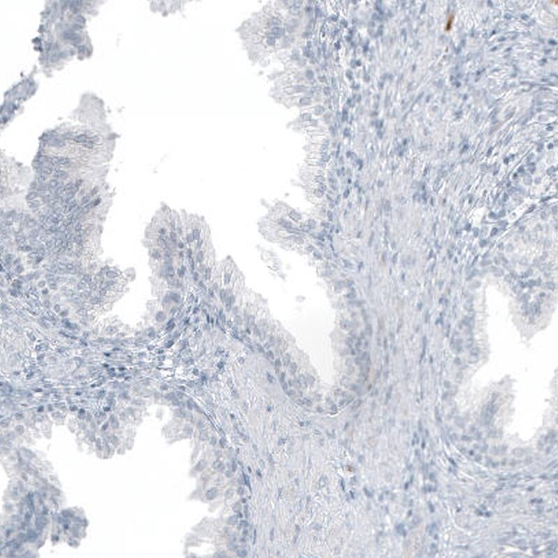 Immunohistochemistry-Paraffin: MUC2 Antibody [NBP3-21168] -
