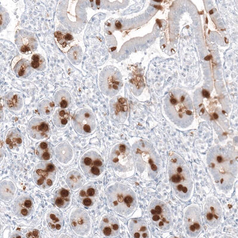 Immunohistochemistry-Paraffin: MUC2 Antibody [NBP3-21168] -