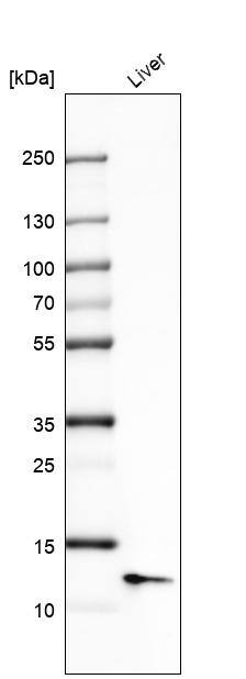 Western Blot: Serum Amyloid A1 Antibody [NBP3-21169] -