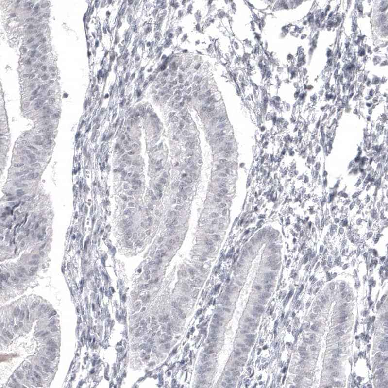 Immunohistochemistry-Paraffin: Serum Amyloid A1 Antibody [NBP3-21169] -