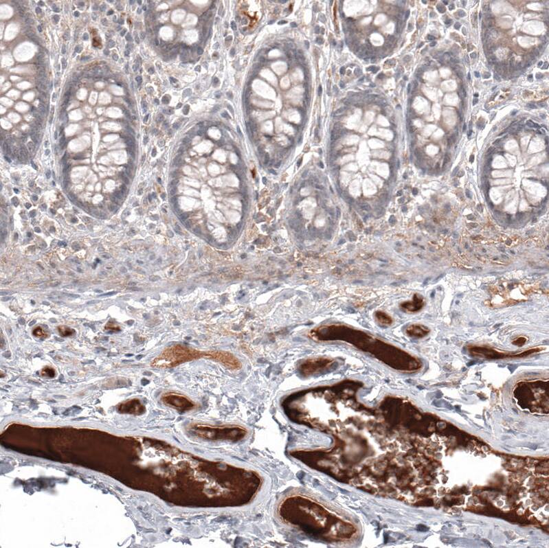 Immunohistochemistry-Paraffin: Serum Amyloid A1 Antibody [NBP3-21169] -