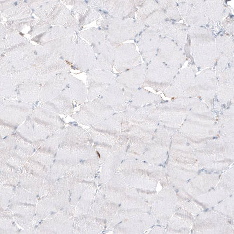 Immunohistochemistry-Paraffin: beta-1,3-Glucuronyltransferase 1/B3GAT1 Antibody [NBP3-21171] -