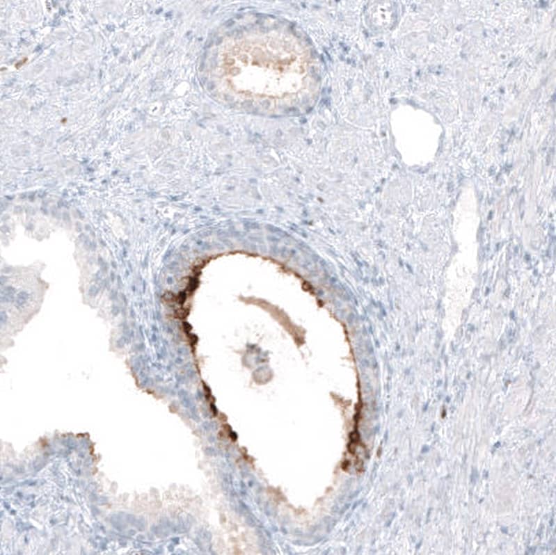 Immunohistochemistry-Paraffin: beta-1,3-Glucuronyltransferase 1/B3GAT1 Antibody [NBP3-21171] -