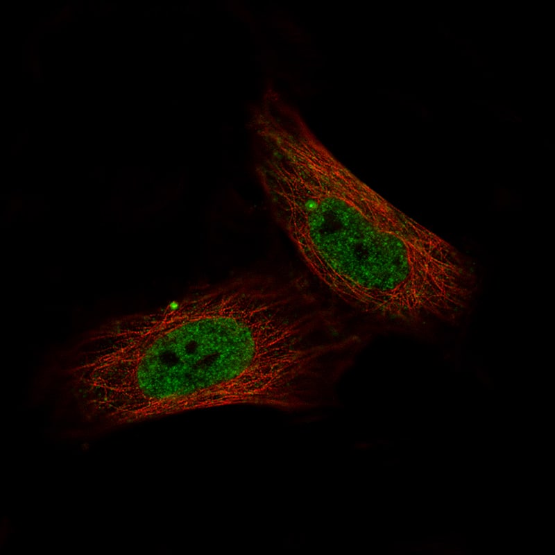 Immunocytochemistry/Immunofluorescence: c-jun Antibody [NBP3-21172] -