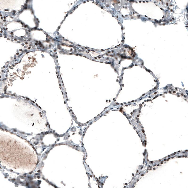 Immunohistochemistry-Paraffin: c-jun Antibody [NBP3-21172] -