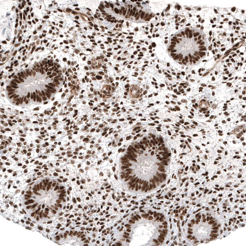 Immunohistochemistry-Paraffin: c-jun Antibody [NBP3-21172] -