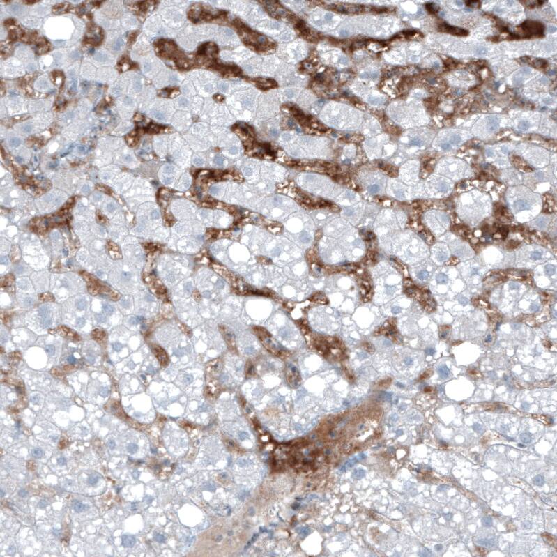 Immunohistochemistry-Paraffin: alpha-Fetoprotein/AFP Antibody [NBP3-21173] -