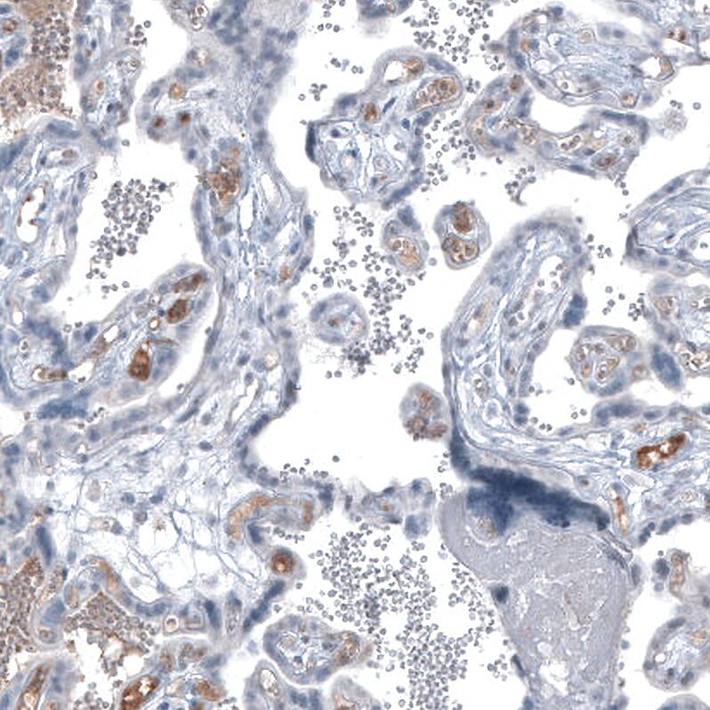 Immunohistochemistry-Paraffin: alpha-Fetoprotein/AFP Antibody [NBP3-21173] -