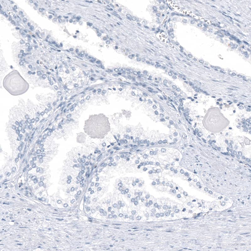 Immunohistochemistry-Paraffin: AGER Antibody [NBP3-21177] -