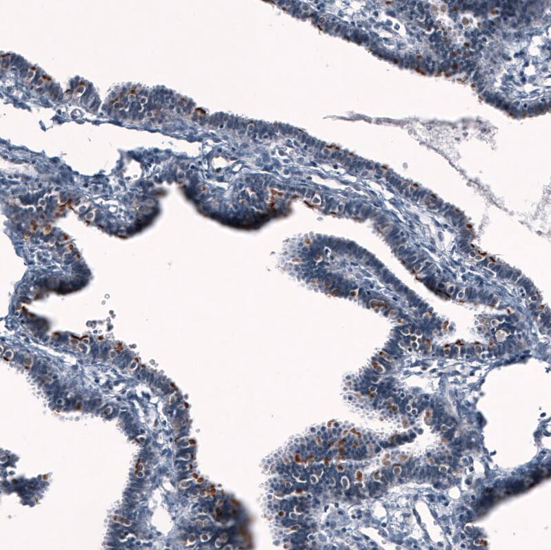 Immunohistochemistry-Paraffin: ANO2 Antibody [NBP3-21178] -