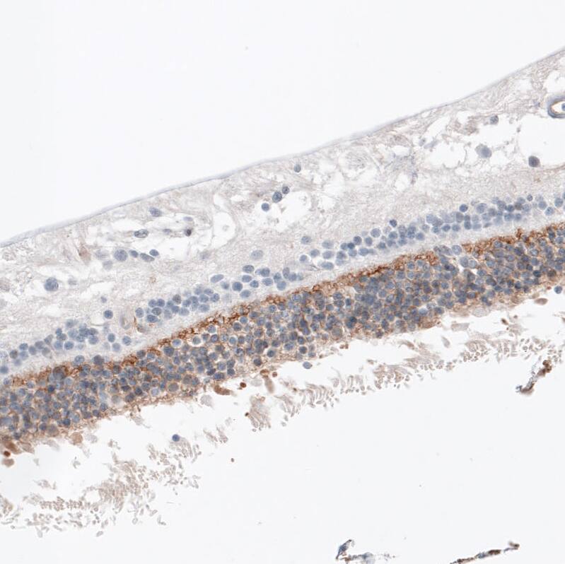 Immunohistochemistry-Paraffin: ANO2 Antibody [NBP3-21178] -